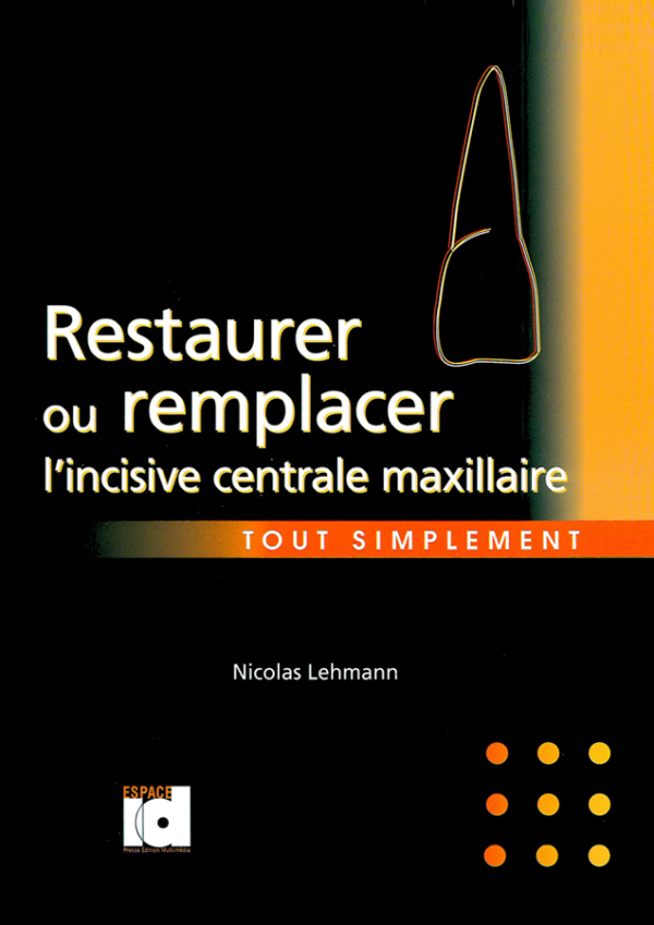 Restaurer ou remplacer l'incisive maxillaire tout simplement